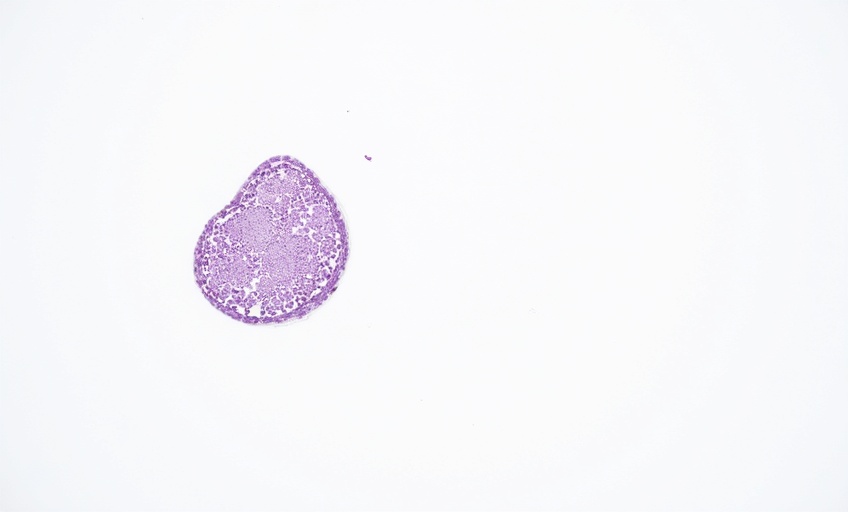 Immunohistochemistry